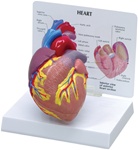 Cutaway Heart Model